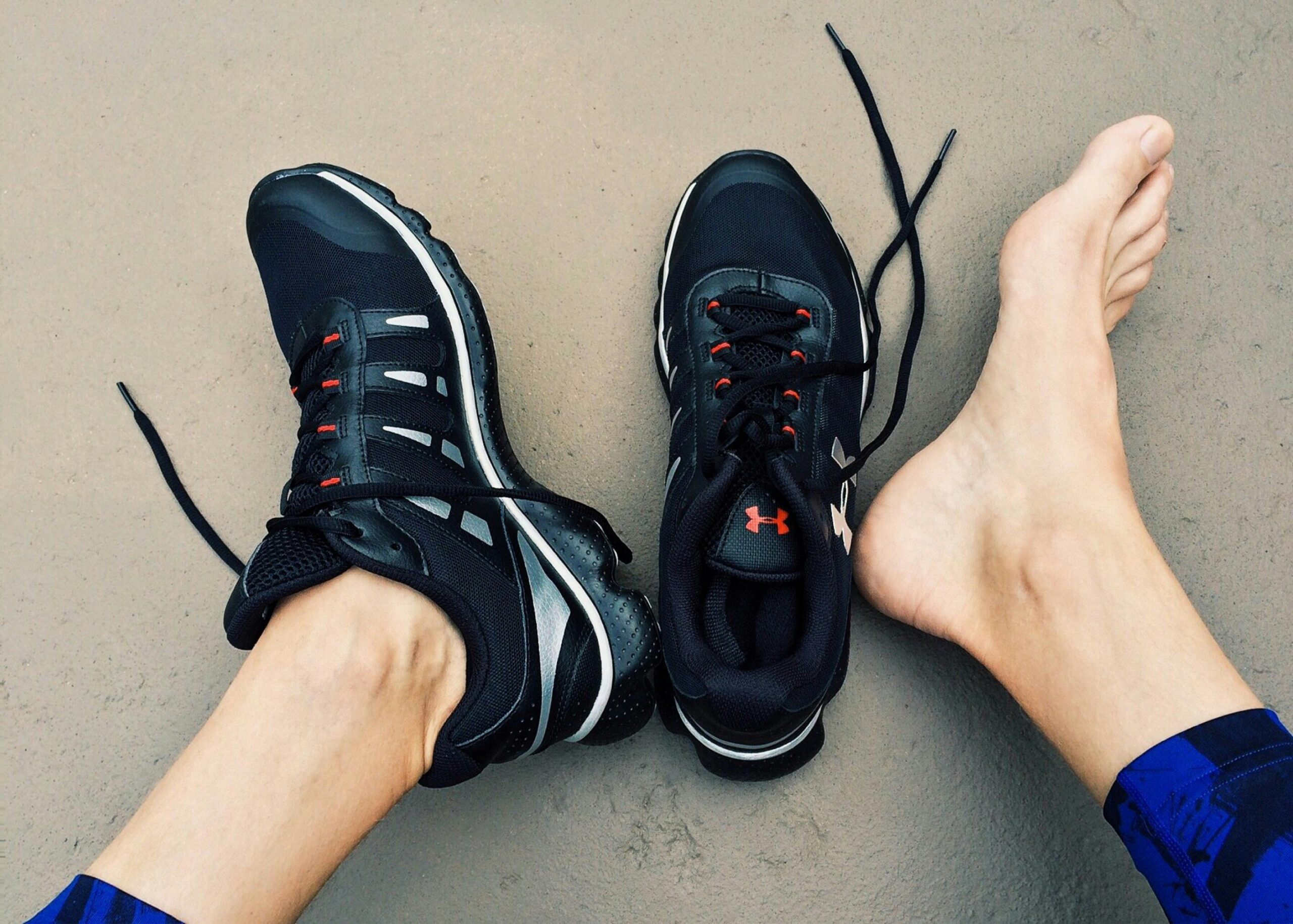 Did You Feel a “Pop!” in Your Heel? Understanding Achilles Tendon Ruptures vs. Tears